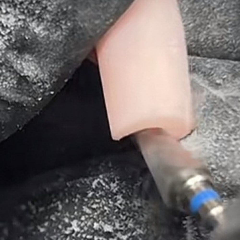 De cone bit is actie voor de c-curve netjes te maken bj de vinger